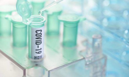 Covid-19 için aynı hedef farklı testler ; PCR, Seroloji